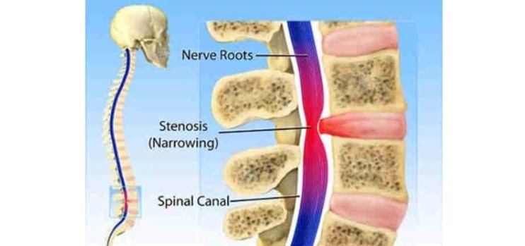 My Back Pain Coach Review. Is It a Scam?