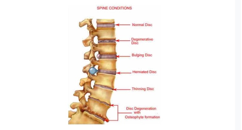 My Back Pain Coach Review. Is It a Scam?